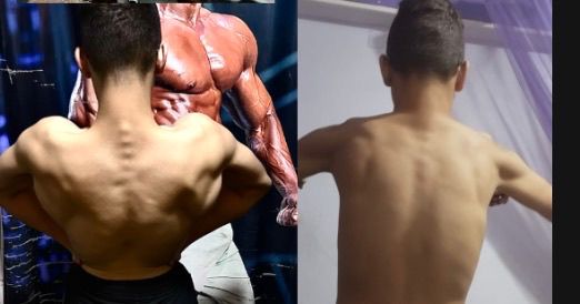 Champion Transformation